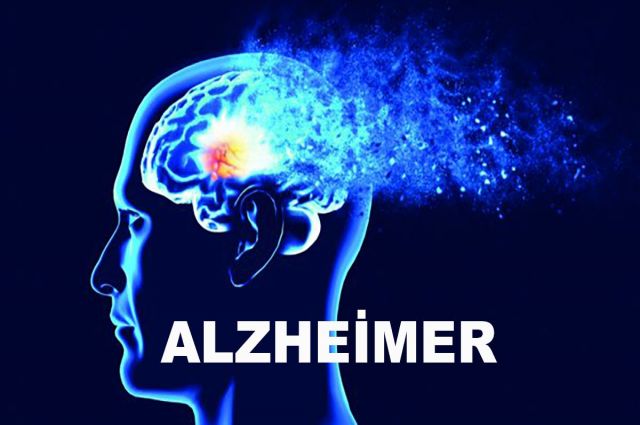 ALZHEİMER