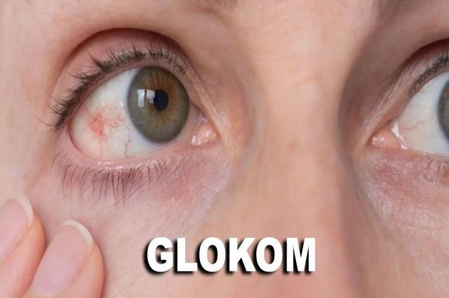 GLOKOM